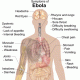 Ebola symptons
